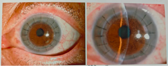 QQ图片20240617120501